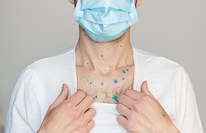 Безобидна ли ветрянка — Статьи, фото №1