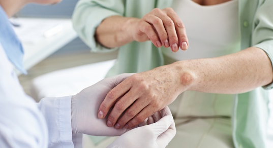 Карбункул – изображение №1 Карбункул – Заболевания, фото №1