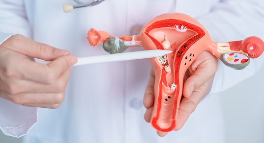 Задержка месячных – изображение №2 Задержка месячных – Симптомы, фото №2