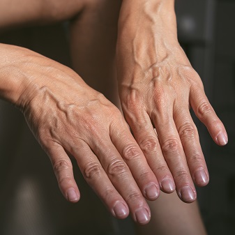 Вздулась вена на руке: Причины, симптомы и что делать  – Симптомы, фото №1