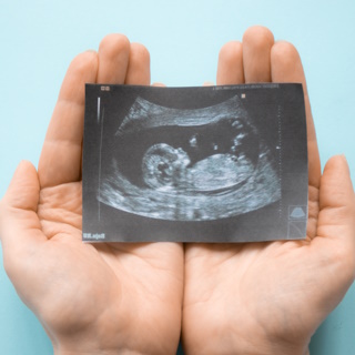 УЗИ при беременности – Анализы и диагностика, фото №3