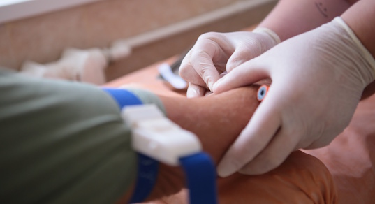 Фурункул – изображение №2 Фурункул – Заболевания, фото №2