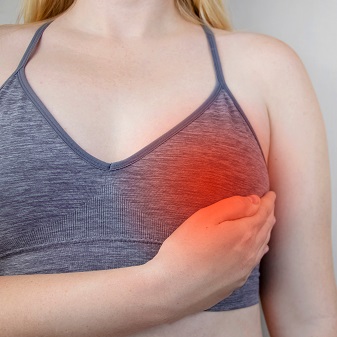 Отек молочных желез – изображение №1 Отек молочных желез – Симптомы, фото №1