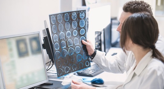 Эпилепсия – Заболевания, фото №1