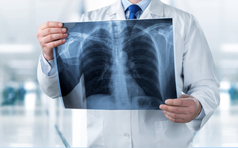 Рентген легких и грудной клетки – Анализы и диагностика, фото №2